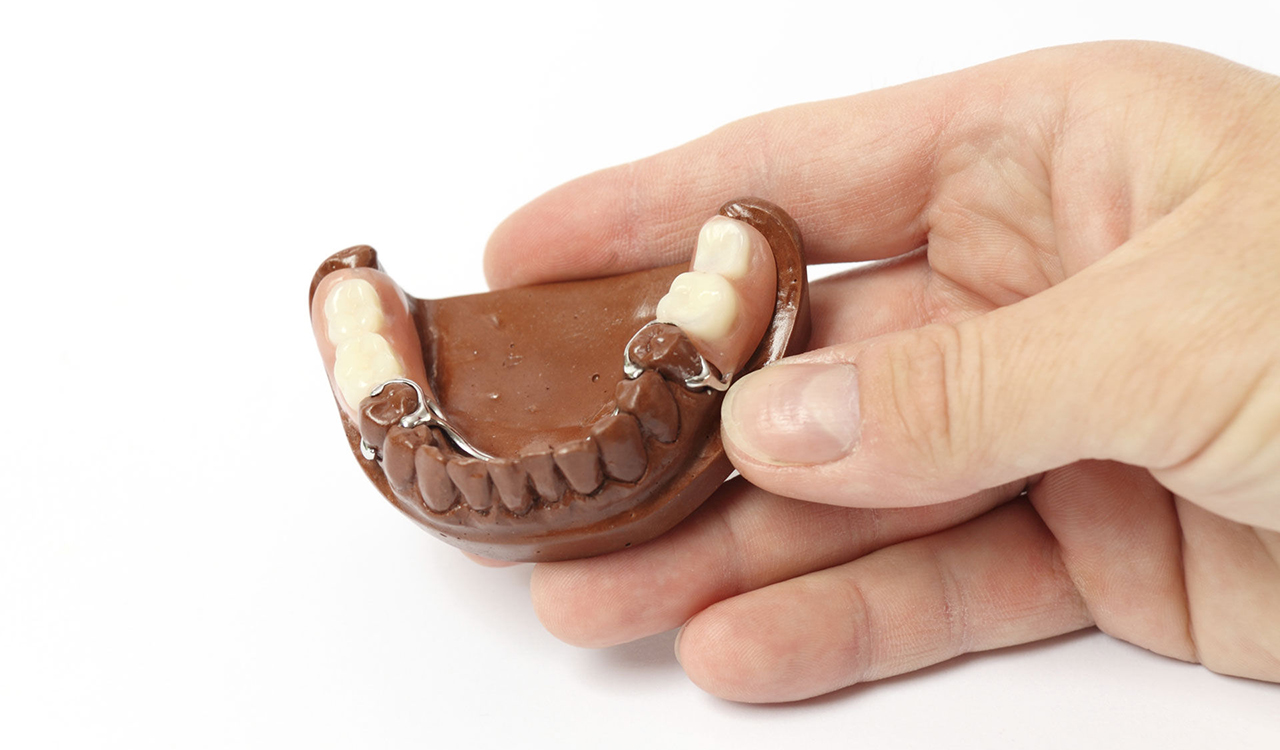 Переваги та недоліки різних видів протезування