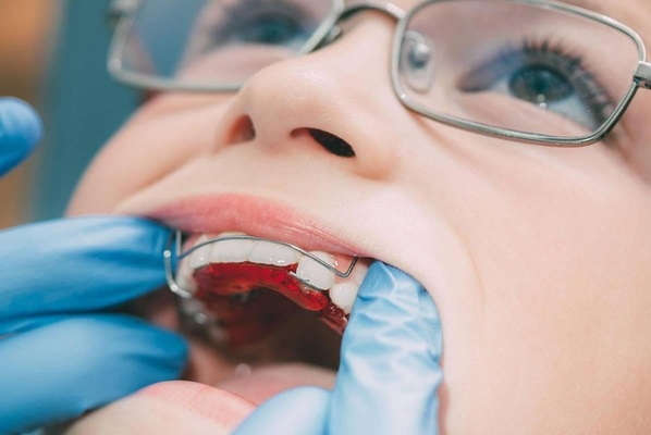 Пластинка на зуби